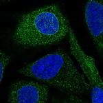 BRAP Polyclonal Antibody