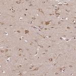 BRAP Antibody in Immunohistochemistry (Paraffin) (IHC (P))