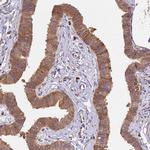 BRAP Antibody in Immunohistochemistry (Paraffin) (IHC (P))