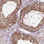 BRAP Antibody in Immunohistochemistry (Paraffin) (IHC (P))