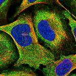 PIGN Antibody in Immunocytochemistry (ICC/IF)