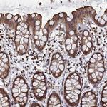 PIGN Antibody in Immunohistochemistry (IHC)