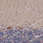 CKAP5 Antibody in Immunohistochemistry (IHC)