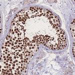 ZNF662 Polyclonal Antibody