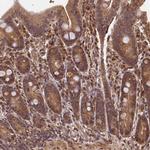 CEP57L1 Antibody in Immunohistochemistry (Paraffin) (IHC (P))