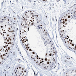 SLTM Antibody in Immunohistochemistry (Paraffin) (IHC (P))