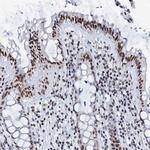 SLTM Antibody in Immunohistochemistry (IHC)