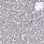 NBEA Antibody in Immunohistochemistry (Paraffin) (IHC (P))