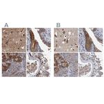 NBEA Antibody in Immunohistochemistry (IHC)
