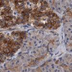 NBEA Antibody in Immunohistochemistry (IHC)