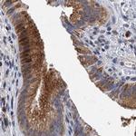 NBEA Antibody in Immunohistochemistry (IHC)