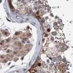 NBEA Antibody in Immunohistochemistry (IHC)