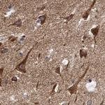 NBEA Antibody in Immunohistochemistry (IHC)