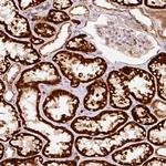 ARHGAP22 Polyclonal Antibody