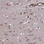 FCP1 Polyclonal Antibody