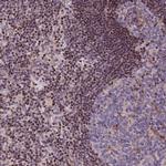 SP4 Antibody in Immunohistochemistry (Paraffin) (IHC (P))