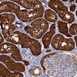 beta L Crystallin Antibody in Immunohistochemistry (Paraffin) (IHC (P))