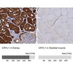 beta L Crystallin Antibody in Immunohistochemistry (IHC)