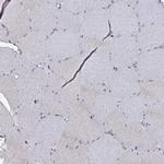 beta L Crystallin Antibody in Immunohistochemistry (IHC)