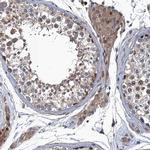 MDM1 Polyclonal Antibody