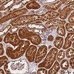 SPG11 Antibody in Immunohistochemistry (Paraffin) (IHC (P))
