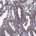 NEK1 Antibody in Immunohistochemistry (Paraffin) (IHC (P))