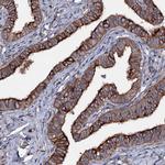 NEK1 Antibody in Immunohistochemistry (Paraffin) (IHC (P))