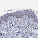 NEK1 Antibody in Immunohistochemistry (Paraffin) (IHC (P))