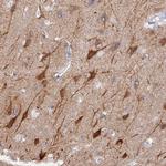 VPS33B Antibody in Immunohistochemistry (Paraffin) (IHC (P))