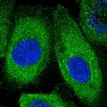 KLC2 Polyclonal Antibody