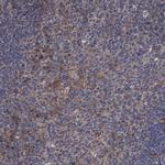 ARHGAP11A Antibody in Immunohistochemistry (IHC)