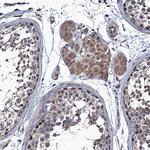 ARHGAP11A Antibody in Immunohistochemistry (IHC)