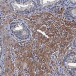 ARHGAP11A Polyclonal Antibody