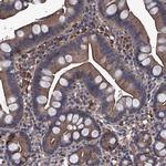 ARHGAP11A Antibody in Immunohistochemistry (IHC)