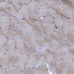 ARHGAP11A Antibody in Immunohistochemistry (IHC)