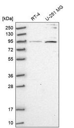 ARHGAP11A Antibody in Western Blot (WB)