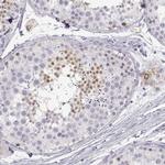 NUTM1 Antibody in Immunohistochemistry (IHC)