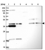 UBL7 Antibody in Western Blot (WB)