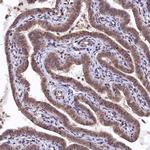 UBL7 Polyclonal Antibody