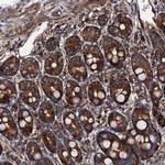 MOS Antibody in Immunohistochemistry (Paraffin) (IHC (P))