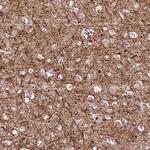 C2CD3 Polyclonal Antibody