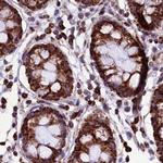 KLC2 Antibody in Immunohistochemistry (IHC)