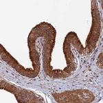 SPG21 Polyclonal Antibody