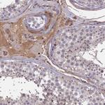 ADO Antibody in Immunohistochemistry (IHC)