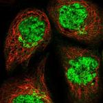 COG6 Polyclonal Antibody