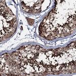 COG6 Antibody in Immunohistochemistry (Paraffin) (IHC (P))