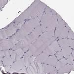 Cystatin F Polyclonal Antibody