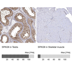 JLP Antibody in Immunohistochemistry (Paraffin) (IHC (P))