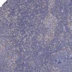 JLP Antibody in Immunohistochemistry (Paraffin) (IHC (P))