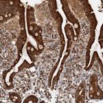 REP15 Polyclonal Antibody